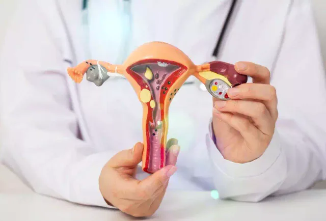 Síndrome dos Ovários Poliquísticos afeta até 15% das mulheres, mas “não é uma sentença de infertilidade”